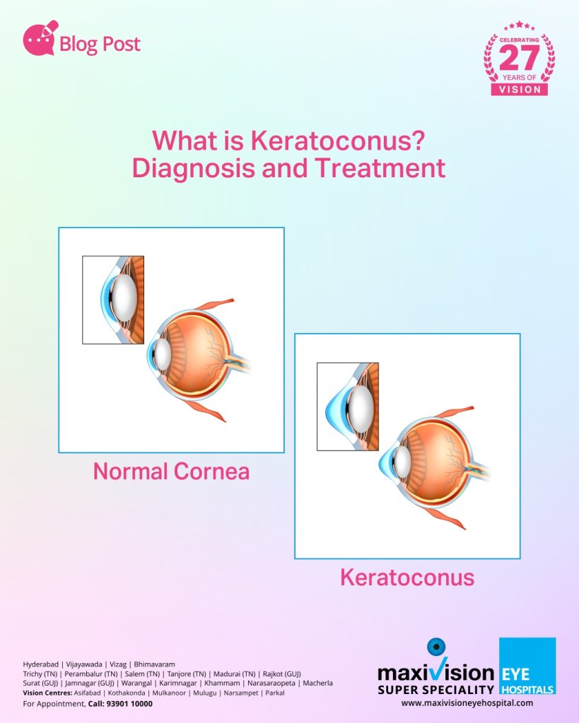 Diagnosis and Treatment