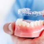 Benefits of Using Ortho Jet Acrylic Resin in Orthodontics A Comprehensive Guide