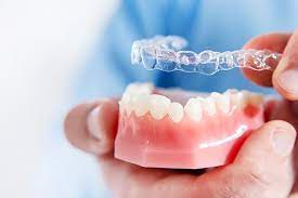 Benefits of Using Ortho Jet Acrylic Resin in Orthodontics A Comprehensive Guide